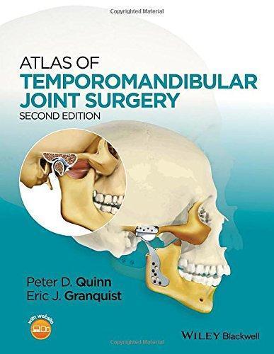 Atlas Of Temporomandibular Joint Surgery 2Nd Edition