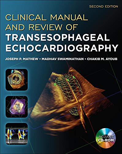 Clinical Manual and Review of Transesophageal Echocardiography, Second Edition 2nd Edition