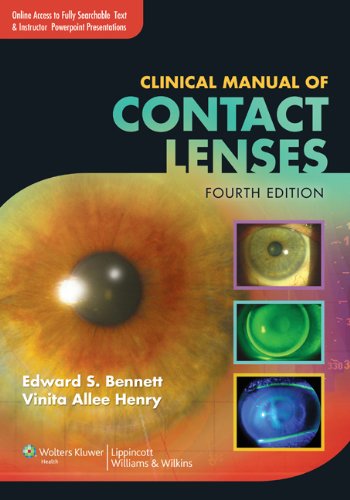 Clinical Manual of Contact Lenses – 4th Edition