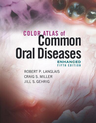 Color Atlas Of Common Oral Diseases Enhanced 5Th Edition