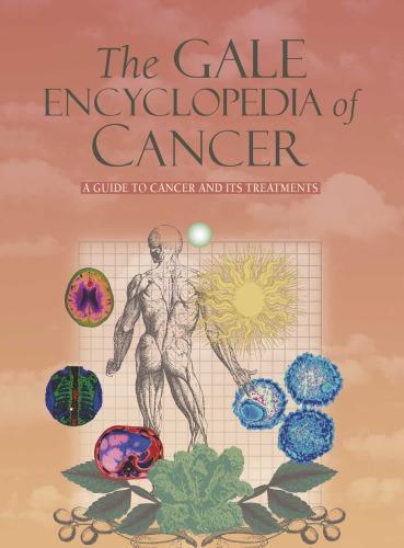 The Gale Encyclopedia Of Cancer 4Th Edition
